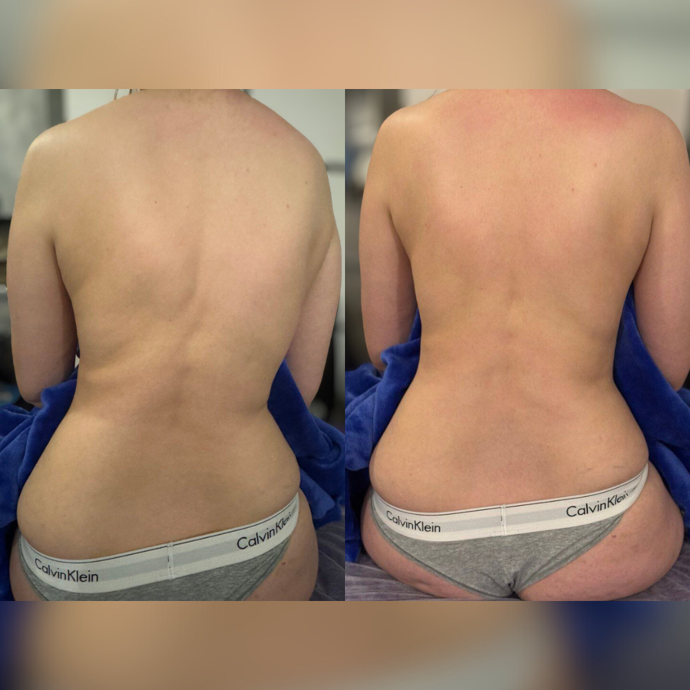 Результат клиента 2.png