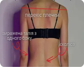Комплексне лікування болю у спині