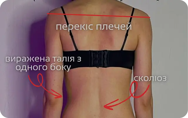 Біль у спині
